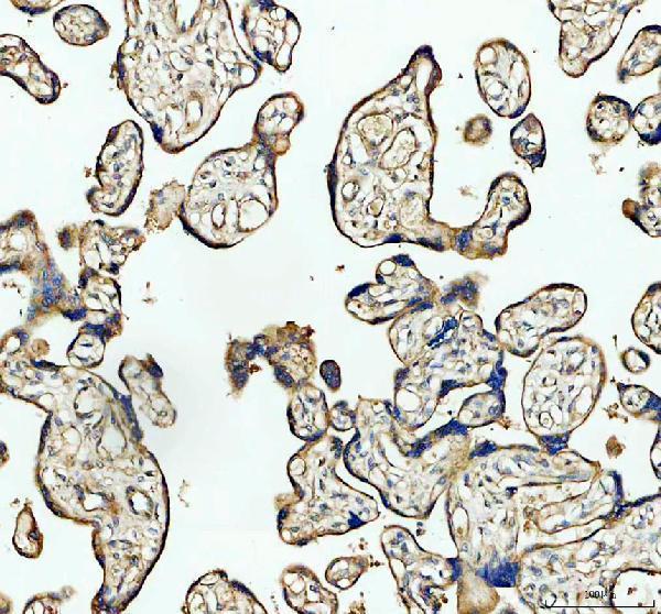 a05917 2 p4ha1 primary antibodies ihc testing 2_2