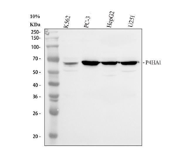 Western blot analysis of P4HA1 using anti-P4HA1 antibody (A05917-2)