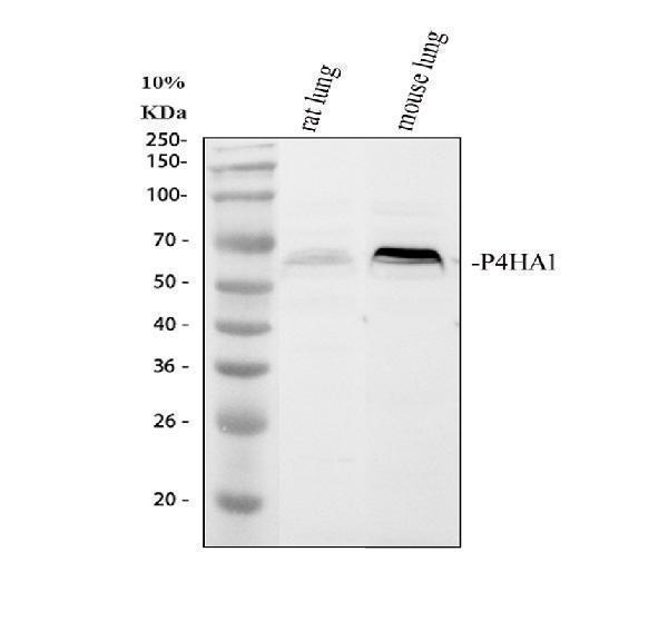 Western blot analysis of P4HA1 using anti-P4HA1 antibody (A05917-2)