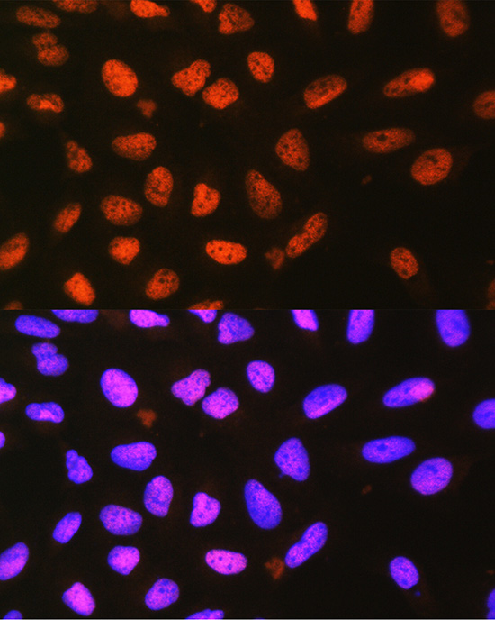 a05917 p4ha1 primary antiboties if testing 3