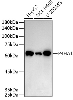 a05917 p4ha1 primary antiboties wb testing 1