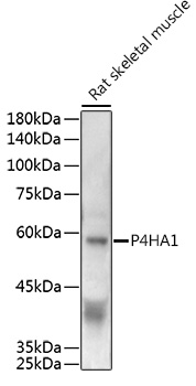 a05917 p4ha1 primary antiboties wb testing 2