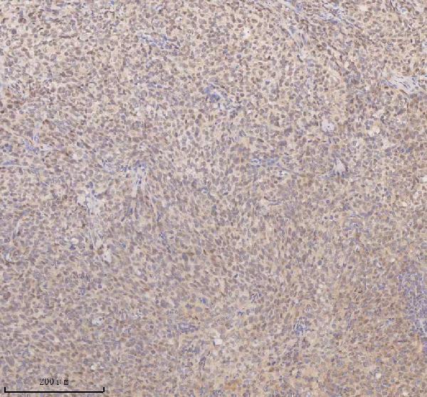 a05918 1 ssx2ip primary antibodies ihc testing 2