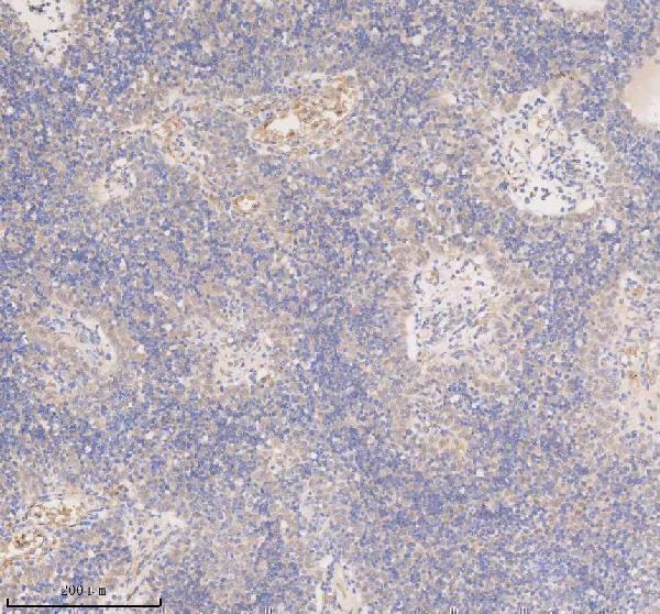 a05918 1 ssx2ip primary antibodies ihc testing 3