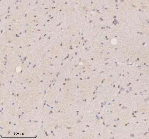 a05918 1 ssx2ip primary antibodies ihc testing 4