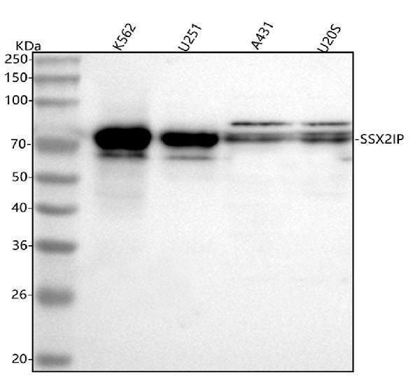 a05918 1 ssx2ip primary antibodies wb testing 1