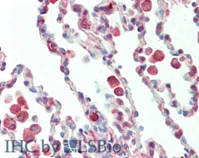 Immunohistochemistry of rabbit anti-Protein Kinase C delta Binding Protein antibody