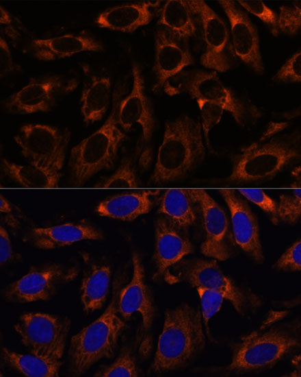 Immunofluorescence analysis of U-2 OS cells using CCT3 antibody  at dilution of 1:100