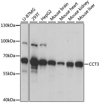 Western blot analysis of extracts of various cell lines, using CCT3 antibody  at 1:1000 dilution