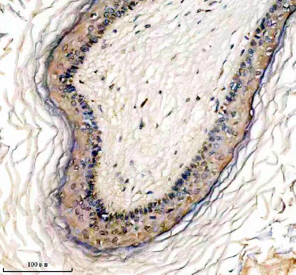 IHC analysis of PELI1 using anti-PELI1 antibody (A05921-1)