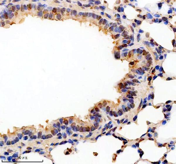 IHC analysis of PELI1 using anti-PELI1 antibody (A05921-1)