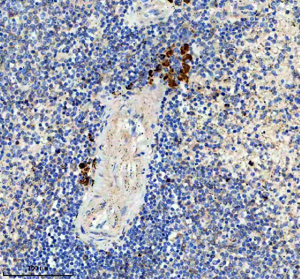 a05922 1 hvcn1 primary antibodies ihc testing 1