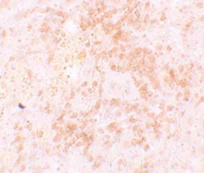 a05922 hvcn1 primary antibodies ihc testing 2