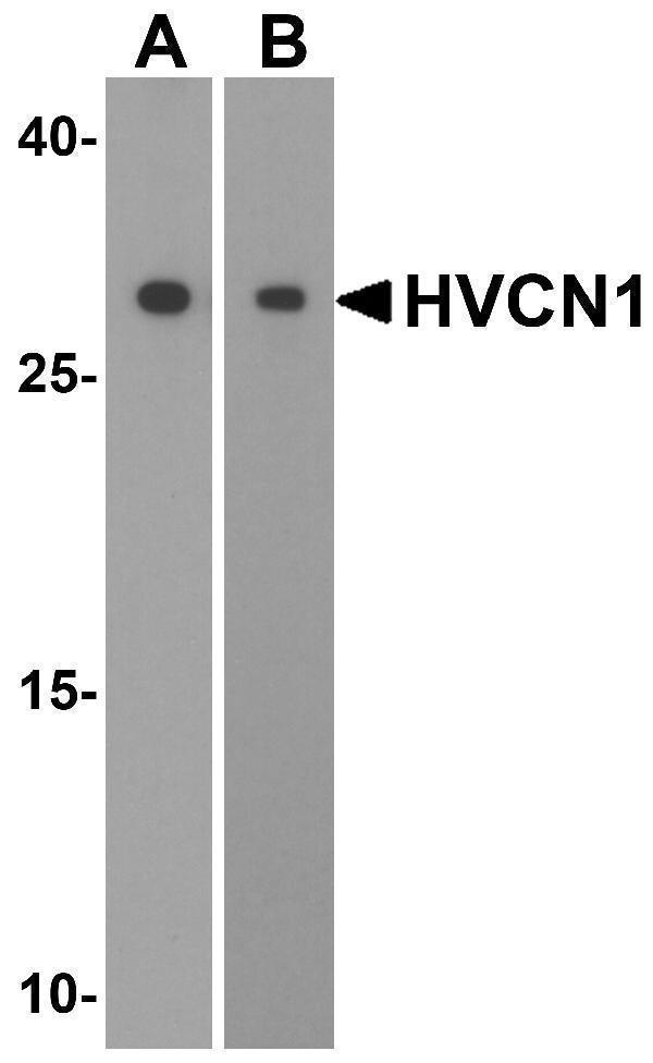 a05922 hvcn1 primary antibodies wb testing 1
