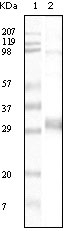 Western Blot (WB) analysis using NPT1 Monoclonal antibody against truncated NPT1 recombinant protein