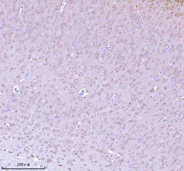 a05924 3 nrtn primary antibodies ihc testing 10