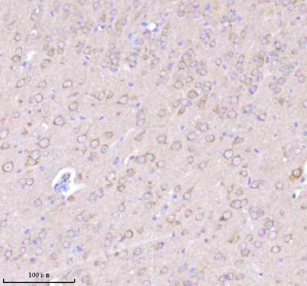 a05924 3 nrtn primary antibodies ihc testing 11