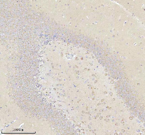 a05924 3 nrtn primary antibodies ihc testing 12