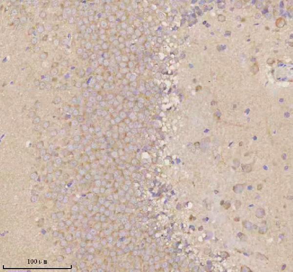 a05924 3 nrtn primary antibodies ihc testing 13