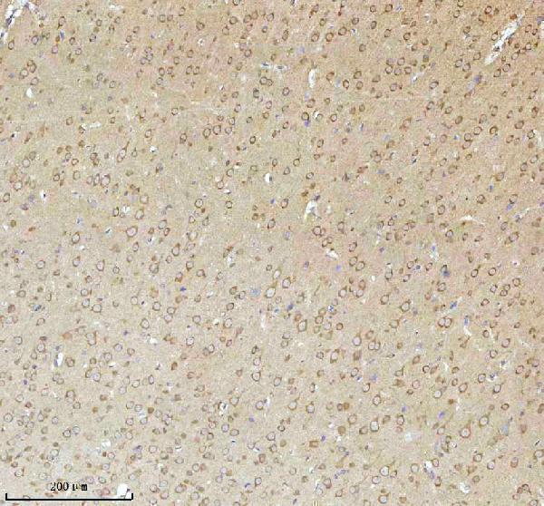 a05924 3 nrtn primary antibodies ihc testing 14
