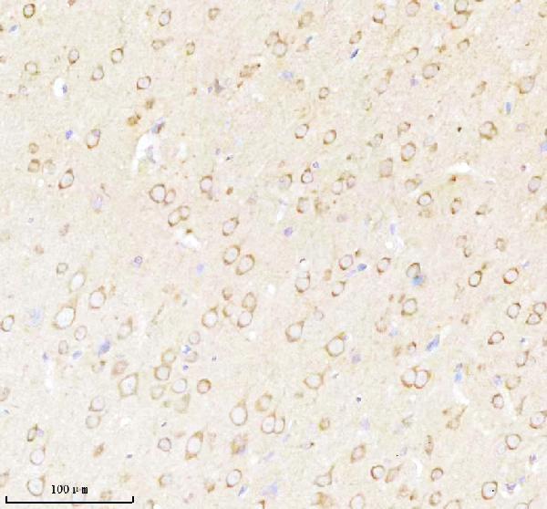 a05924 3 nrtn primary antibodies ihc testing 15