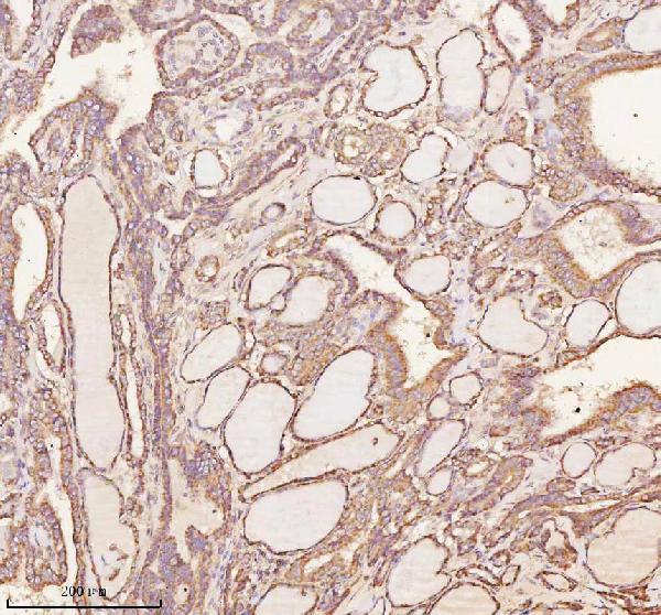 a05924 3 nrtn primary antibodies ihc testing 6