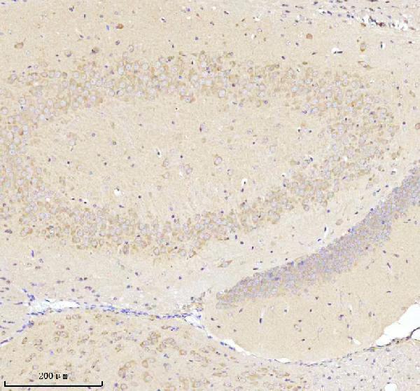 a05924 3 nrtn primary antibodies ihc testing 8