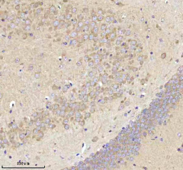 a05924 3 nrtn primary antibodies ihc testing 9