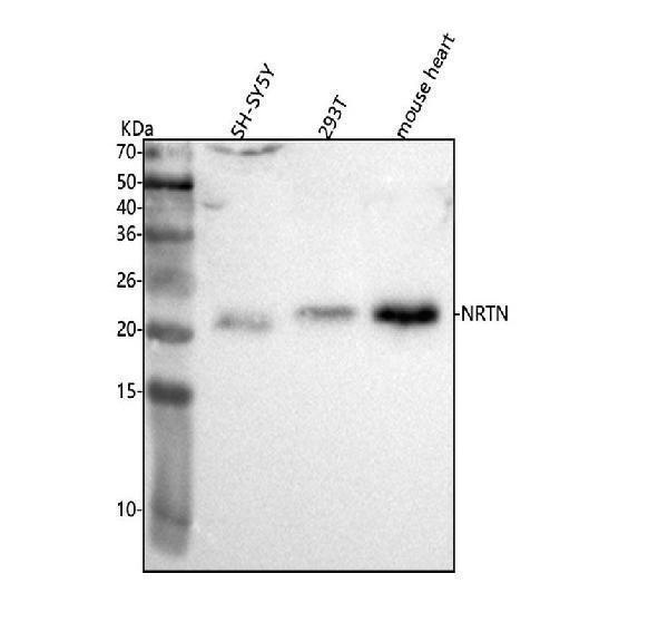  Western blot analysis of NRTN using anti-NRTN antibody (A05924-3)