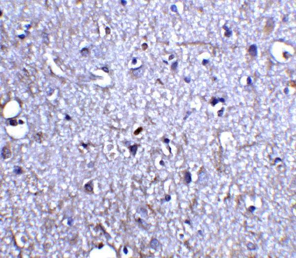 a05924 nrtn primary antibodies ihc testing 4