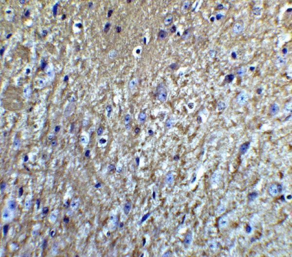 a05924 nrtn primary antibodies ihc testing 5