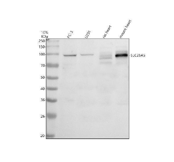 Western blot analysis of SLC26A5 using anti-SLC26A5 antibody (A05925-2)