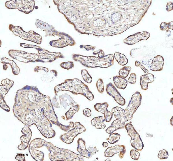  IHC analysis of MIPEP using anti-MIPEP antibody (A05926-1)