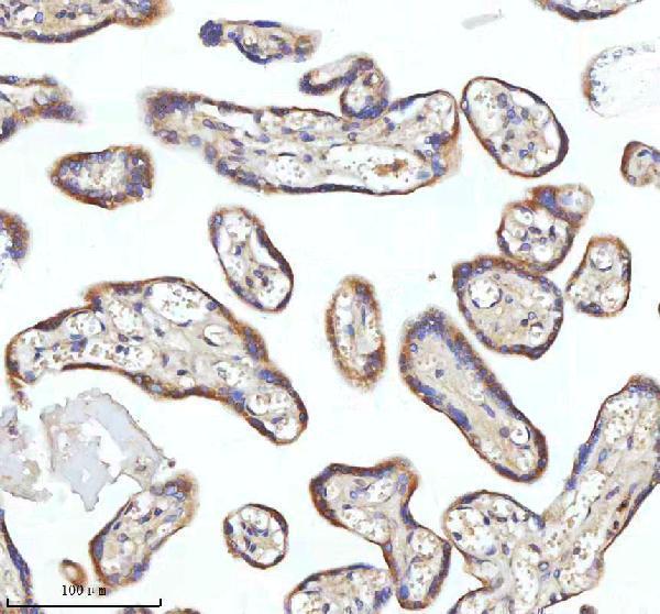  IHC analysis of MIPEP using anti-MIPEP antibody (A05926-1)