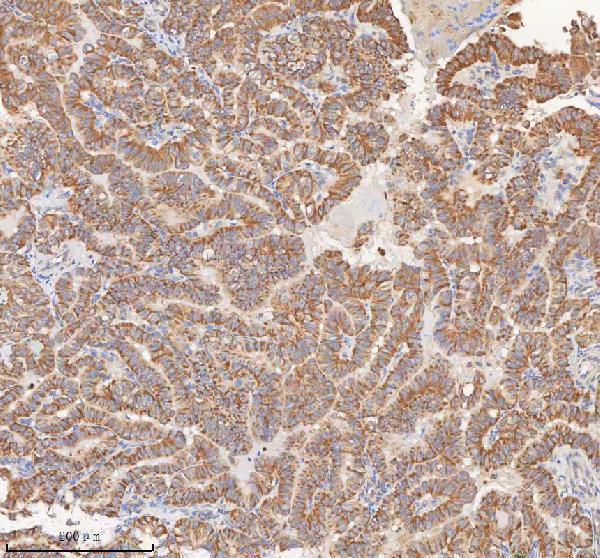 a05926 1 mipep primary antibodies ihc testing 4