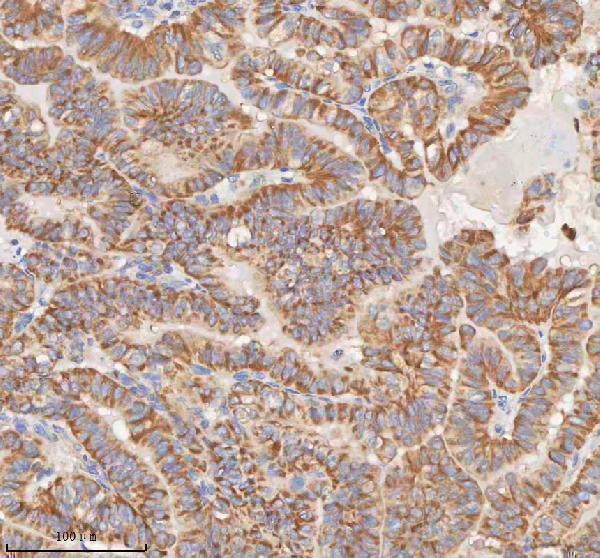 a05926 1 mipep primary antibodies ihc testing 5