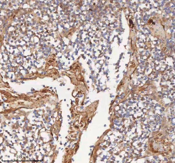 a05926 1 mipep primary antibodies ihc testing 6