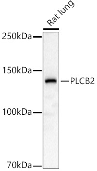 Western blot analysis of extracts of Rat lung, using PLCB2   antibody  at 1:1000 dilution