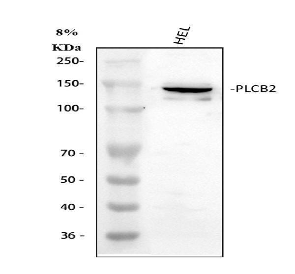  Western blot analysis of PLCB2 using anti-PLCB2 antibody (A05927-2)