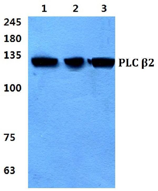 Western blot (WB) analysis of PLC β2 polyclonal antibody at 1:500 dilution
Lane1:Hela cell lysate
Lane2:sp2/0 cell lysate
Lane3:H9C2 cell lysate