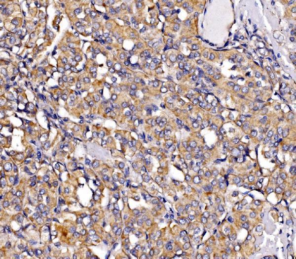  IHC analysis of MIRO1/RHOT1 using anti-MIRO1/RHOT1 antibody (A05928-1)