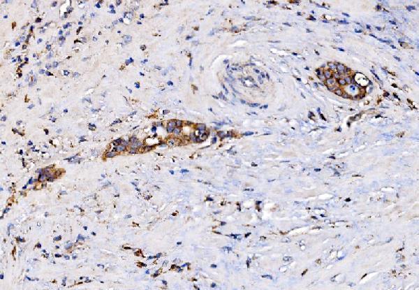 a05928 1 rhot1 primary antibodies ihc testing 3