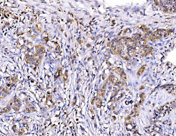 a05928 1 rhot1 primary antibodies ihc testing 5