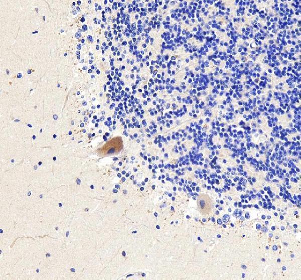IHC analysis of RHOT1 using anti-RHOT1 antibody (A05928-1)