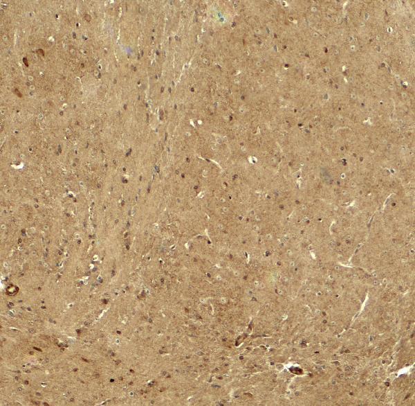 a05928 rhot1 primary antibodies ihc testing 2