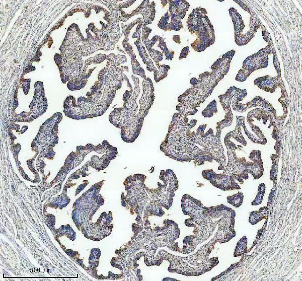 IHC analysis of BBS7 using anti-BBS7 antibody (A05932)