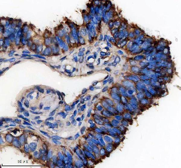 IHC analysis of BBS7 using anti-BBS7 antibody (A05932)