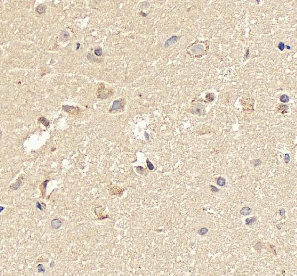 IHC analysis of NEUROG1 using anti-NEUROG1 antibody (A05933-2)