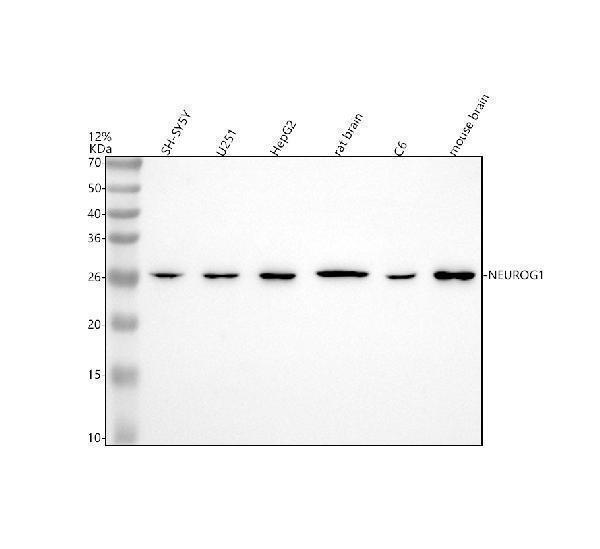 Western blot analysis of NEUROG1 using anti-NEUROG1 antibody (A05933-2)