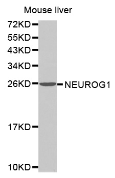 Western blot analysis of NEUROG1 polyclonal antibody